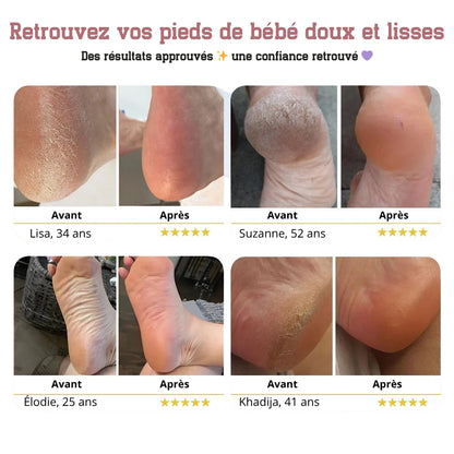 DermaFeet Pro 2.0