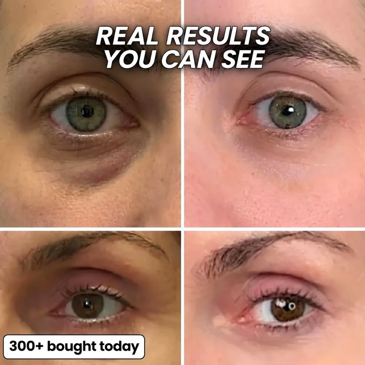 Real results you can see around the eyes