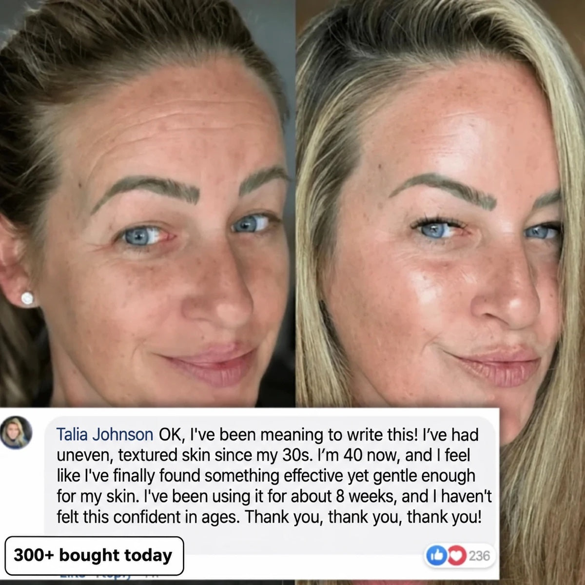 Customer before and after